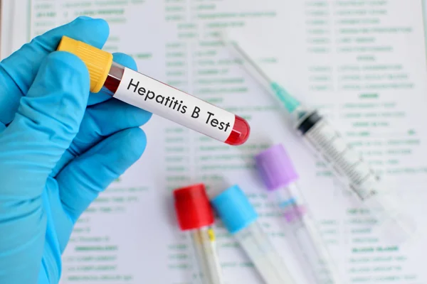Hepatitis B & C