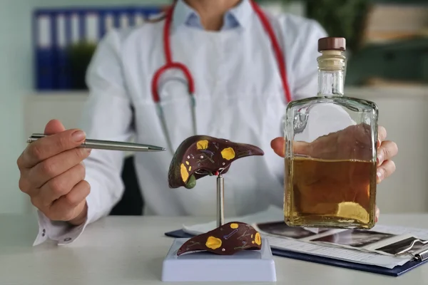 Alcoholic Liver Disease